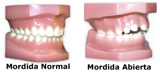 Pregunta cu ndo Debo Retirar El Chupete A Mi Hijo Cl nica Dental Pregunta cu ndo Debo Retirar El Chupete A Mi Hijo Cl nica Dental
